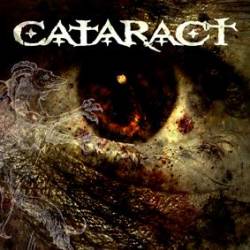 Cataract (CH) : Cataract